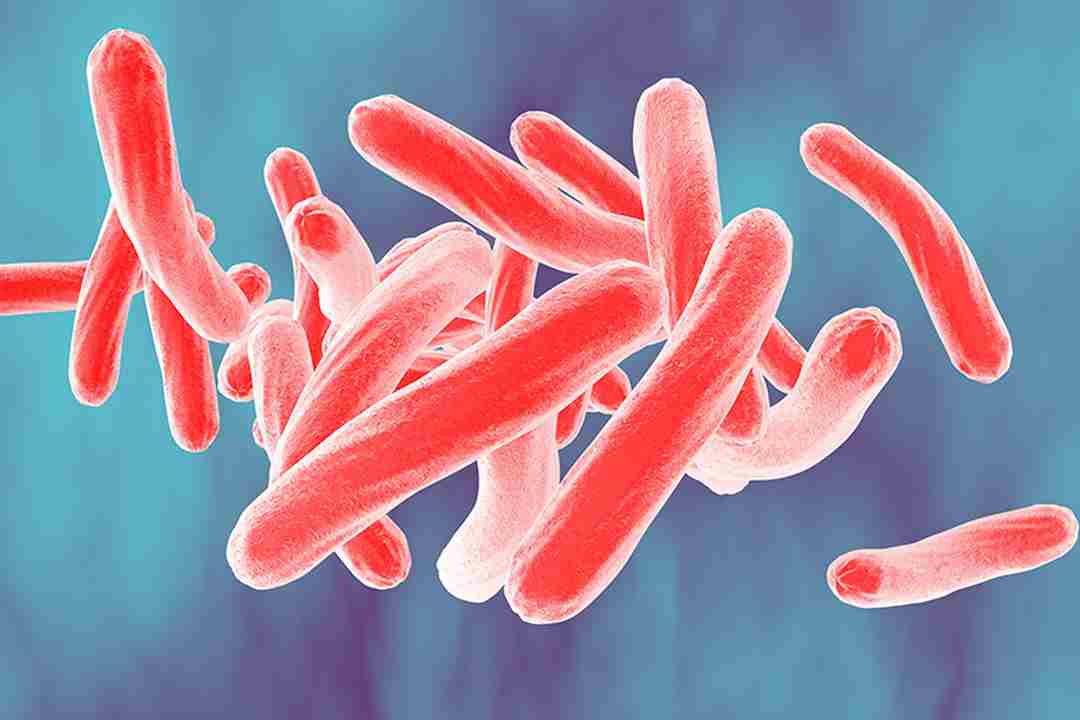 Bệnh lao là do vi khuẩn tên gọi Mycobacterium Tuberculosis gây ra