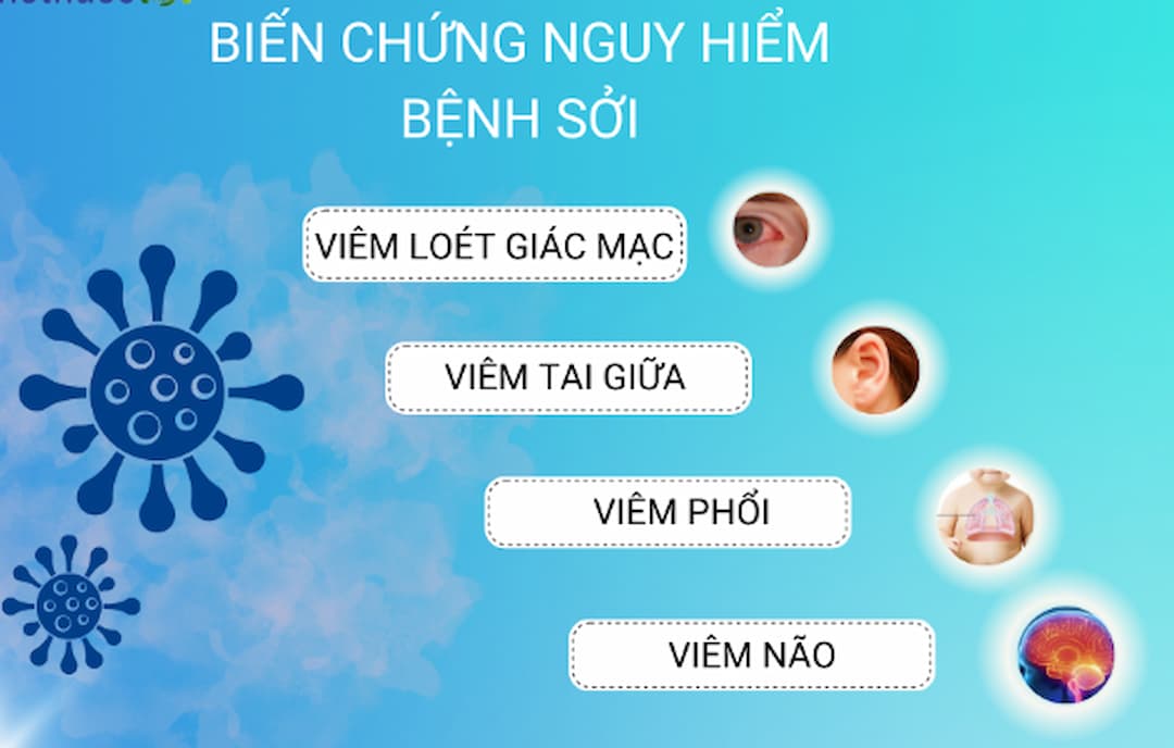 Các biến chứng của bệnh sởi