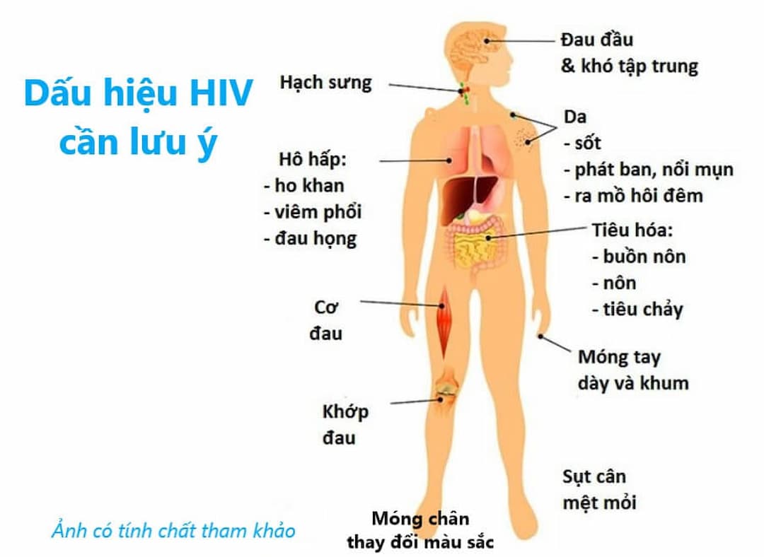 16 dấu hiệu nhiễm HIV cần thăm khám và điều trị cho phù hợp
