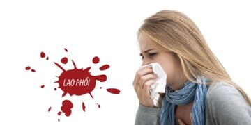 Lao phổi là một trong những hệ lụy do vi khuẩn MTB gây ra