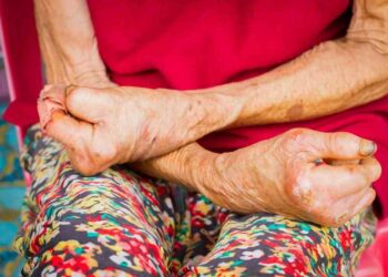 Điều trị bệnh không khó khăn nhưng cần phải phát hiện kịp thời