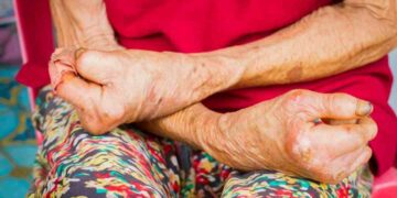 Điều trị bệnh không khó khăn nhưng cần phải phát hiện kịp thời