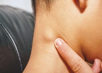 Bệnh dịch hạch xảy ra do ký sinh trùng bọ chét ở trên chuột 