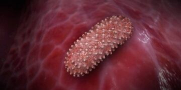 Dịch hạch là một bệnh truyền nhiễm nguy hiểm đến tính mạng