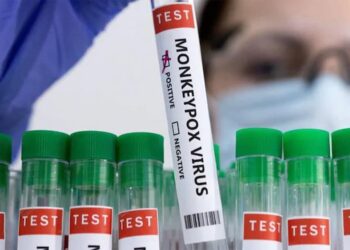 Bệnh đậu mùa khỉ có thuốc chữa không