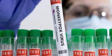 Bệnh đậu mùa khỉ có thuốc chữa không