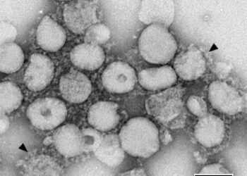 Đại dịch Sar năm 2003