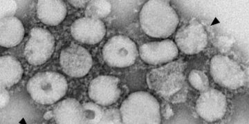 Đại dịch Sar năm 2003