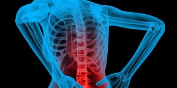 Bệnh lao xương khớp