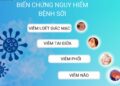 Các biến chứng của bệnh sởi