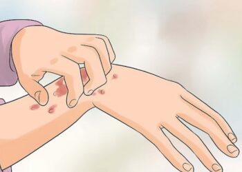 Các giai đoạn HIV và biểu hiện của từng giai đoạn cần biết