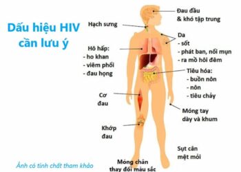 16 dấu hiệu nhiễm HIV cần thăm khám và điều trị cho phù hợp