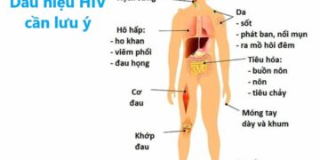 16 dấu hiệu nhiễm HIV cần thăm khám và điều trị cho phù hợp