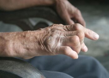 Nguyên nhân gây bệnh phong và các dấu hiệu nhận biết