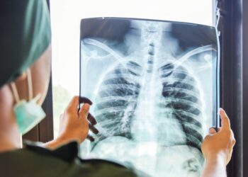 Phác đồ điều trị lao phổi